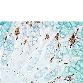 Anti-DNA/RNA Damage Antibody 15A3抗体